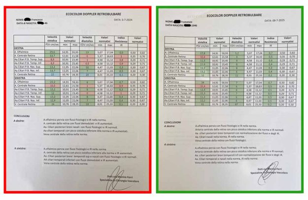 vascolarizzazione dell'occhio prima e dopo l'agopuntura