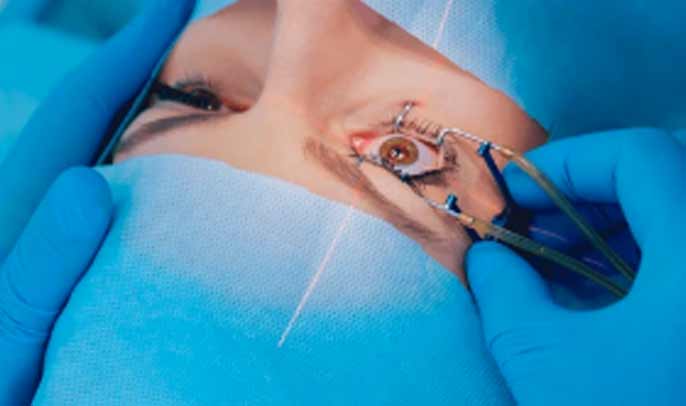 laser-eccimeri1 correggere i difetti visivi: presbiopia, miopia, ipermetropia o astigmatismo. Dr Marzio Vanzini Oculista Bologna