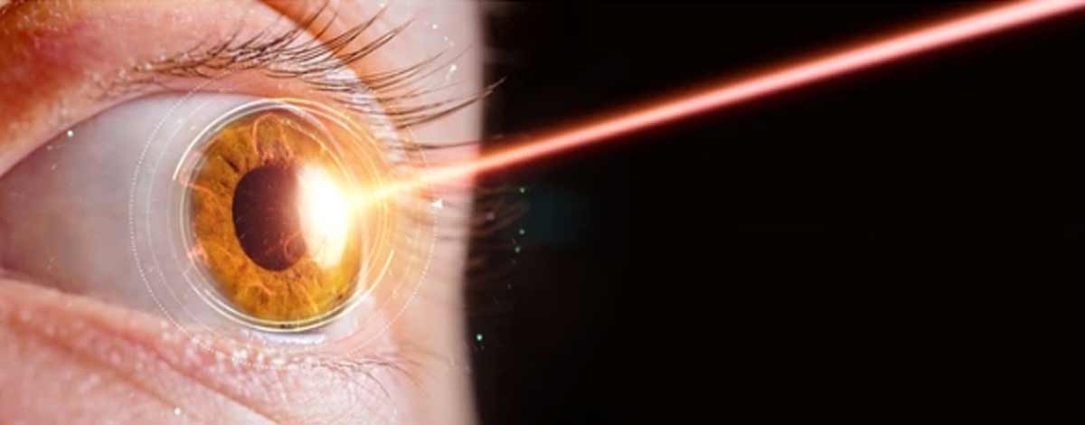 PRK-e-LASIK-laser-a-eccimeri correggere astigmatismo con Laser a eccimeri, correzione difetti visivi Bologna, Dr Marzio Vanzini Bologna