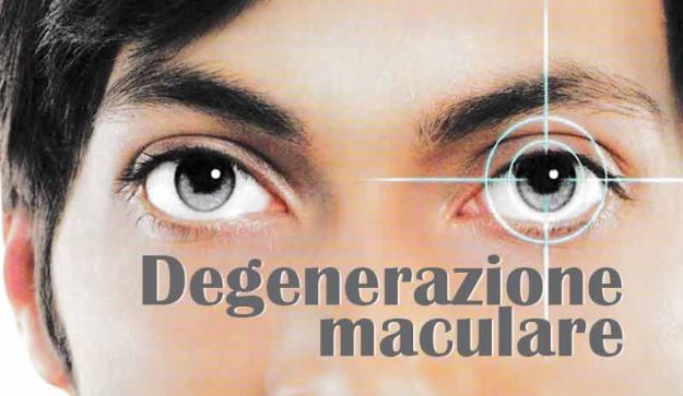 maculopatia secca, maculopatia umida