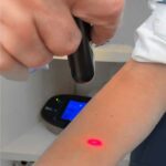 Livia Zanotto-Cura glaucoma con agopuntura Laser Agopuntura, glaucoma, Dr Marzio Vanzini Bologna